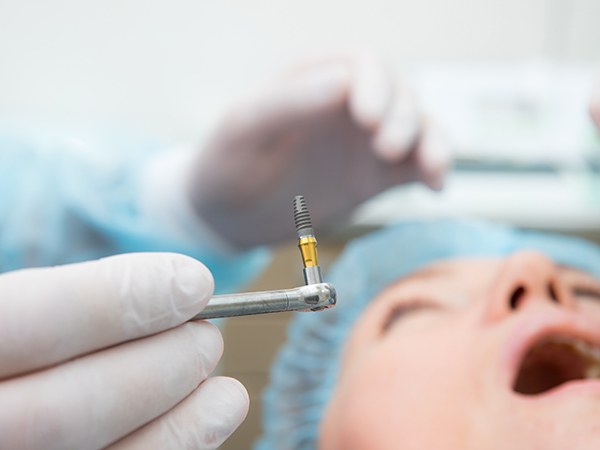dentist holding dental implant during surgery