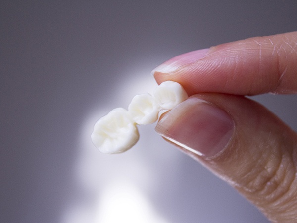 A dental bridge held between two fingers