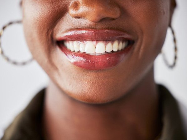 a woman smiling with bright and healthy teeth