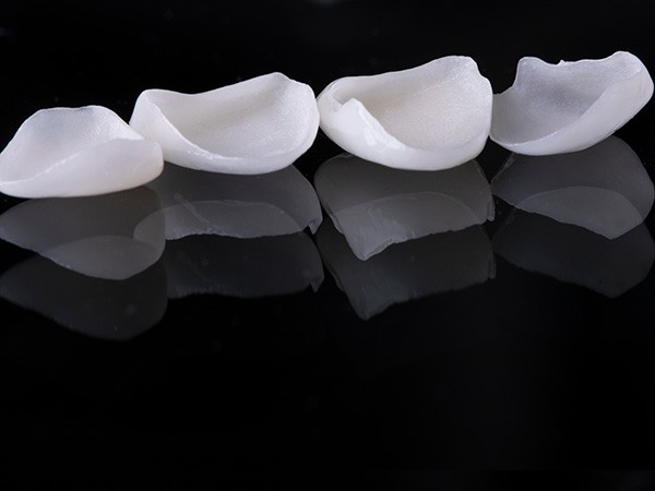 Four dental veneers on reflective black surface