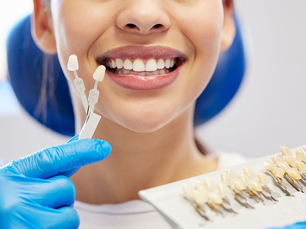 Nose-to-shoulder view of woman in dental chair with shade guide held to teeth