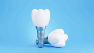 Two dental implants on a blue background